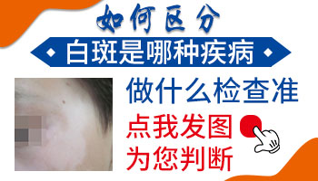 皮肤上长了白斑是什么原因